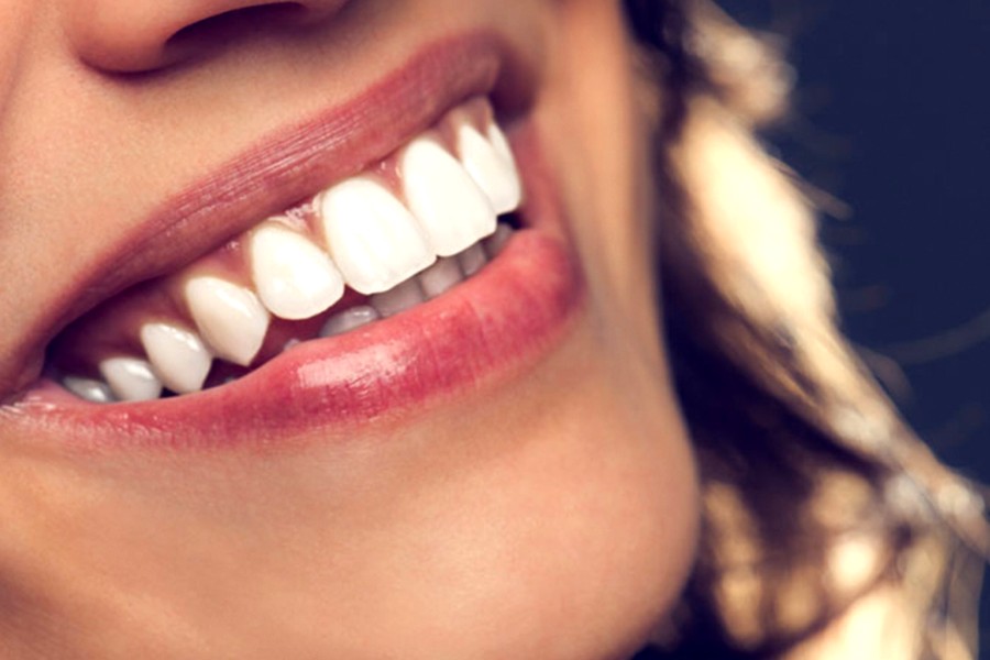 Sponsored Love: Demystifying Celebrity Smile Transformations What The